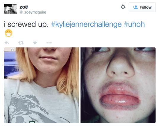 Kylie Jenner Challenge